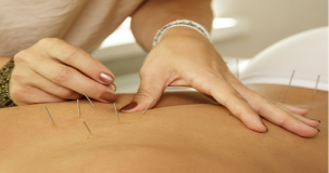 Akupunktur aç mı tok mu?