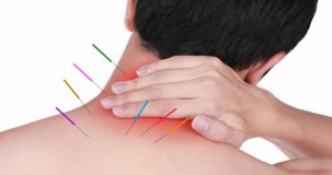 Akupunktur ağrı yapar mı?