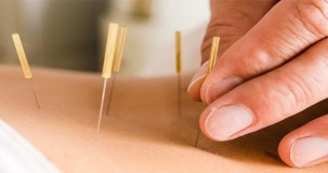 Akupunktur ağrılara iyi gelir mi?